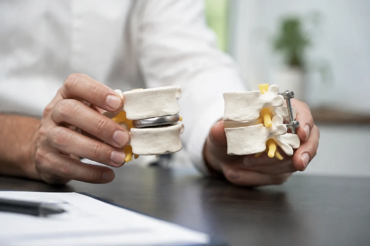 Imagem ilustrativa: Dois modelos médicos de segmento vertebral, um com prótese de disco e outro com fixação, sobre mesa.